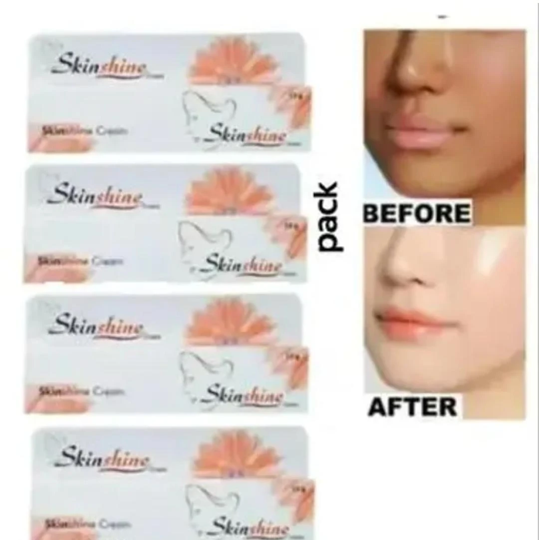 SKINSHINE